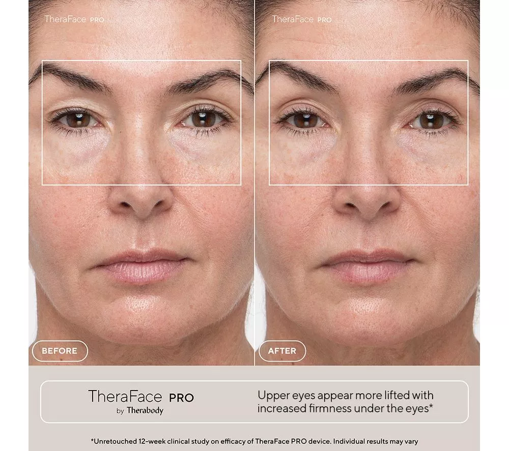 THERABODY TheraFace Pro Face Massager - Black