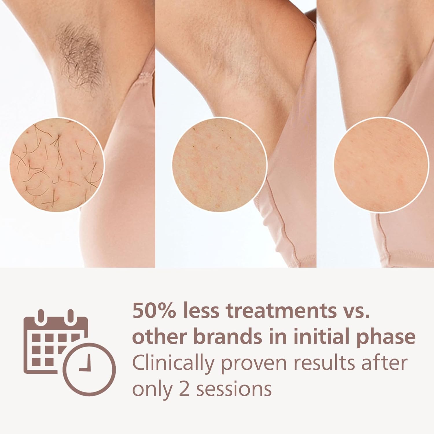 PHILIPS Lumea IPL 7000 Series BRI923 00 IPL Hair Removal System with Pen Trimmer - White